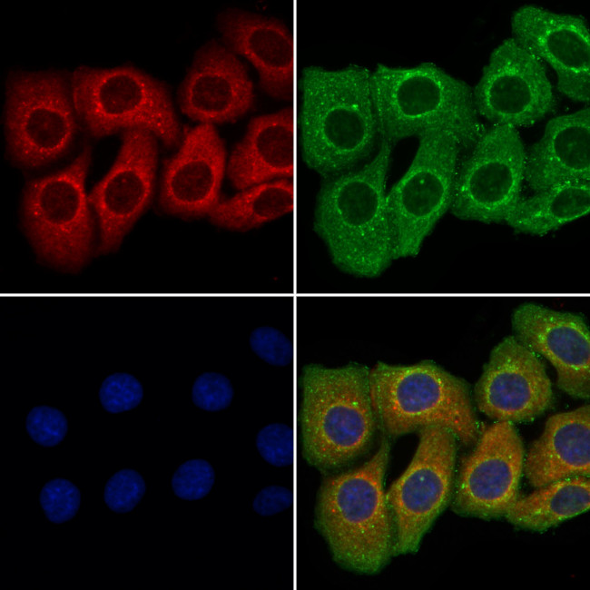COL15A1 Antibody in Immunocytochemistry (ICC/IF)