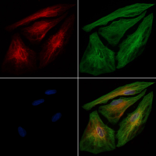 ENTPD5 Antibody in Immunocytochemistry (ICC/IF)