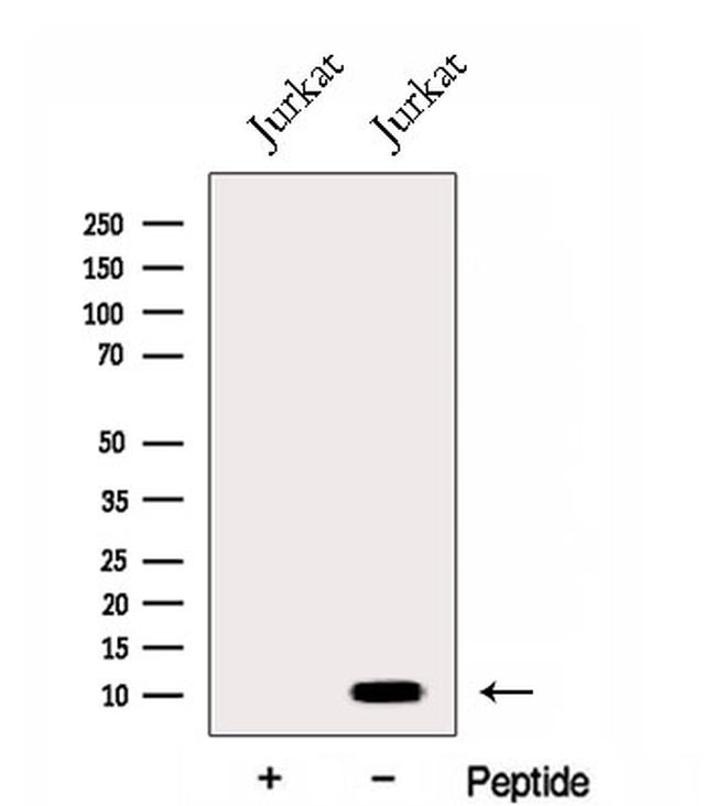 ENY2 Antibody in Western Blot (WB)