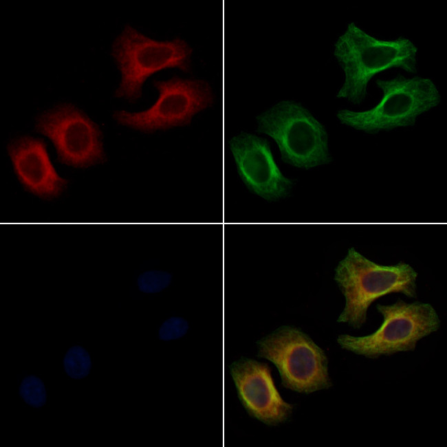 EPHA3 Antibody in Immunocytochemistry (ICC/IF)