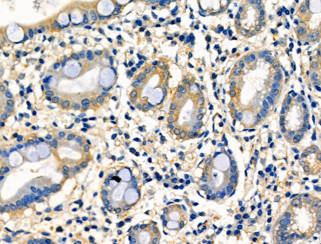 EphB6 Antibody in Immunohistochemistry (Paraffin) (IHC (P))