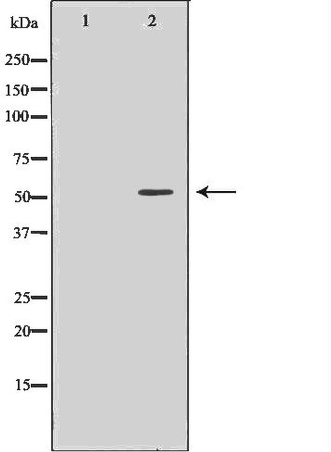 EpoR Antibody in Western Blot (WB)