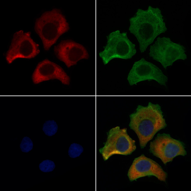 ERO1L Antibody in Immunocytochemistry (ICC/IF)