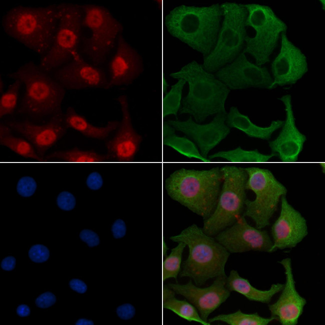 SMG6 Antibody in Immunocytochemistry (ICC/IF)