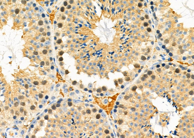 FABP4 Antibody in Immunohistochemistry (Paraffin) (IHC (P))