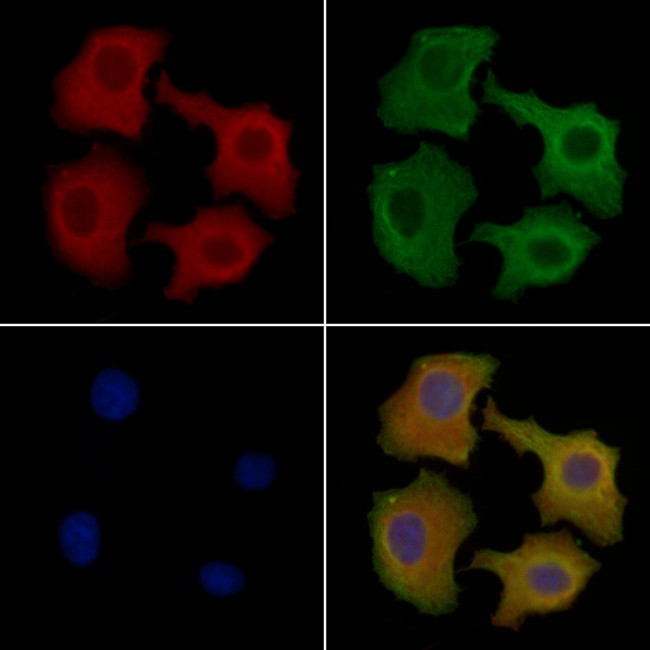 FASTKD1 Antibody in Immunocytochemistry (ICC/IF)