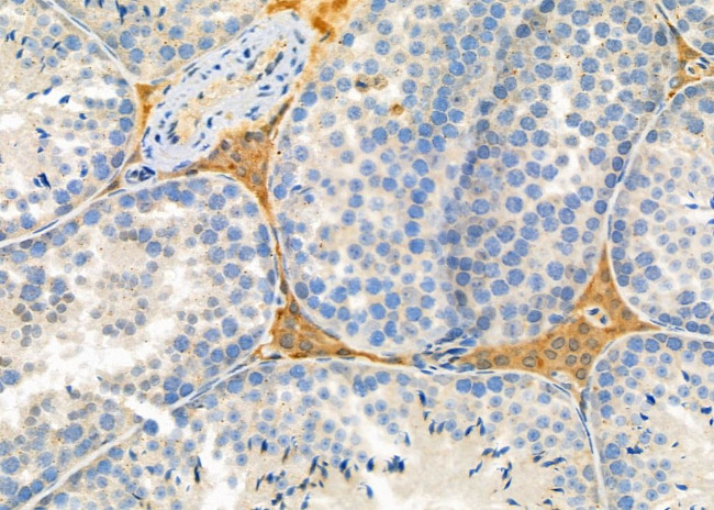 FASTKD5 Antibody in Immunohistochemistry (Paraffin) (IHC (P))