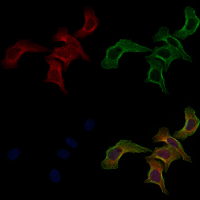 FAS (CD95) Antibody in Immunocytochemistry (ICC/IF)