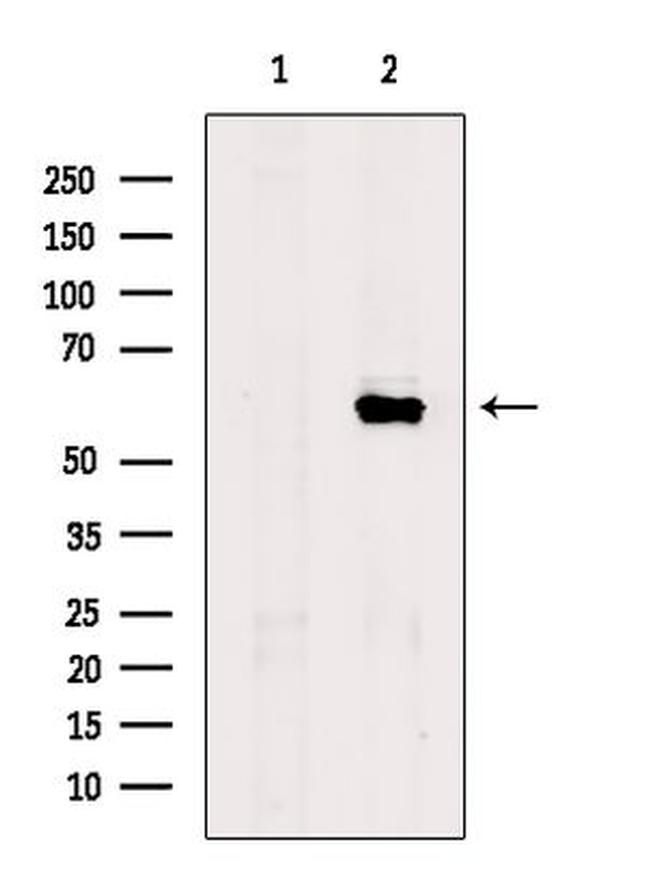 FUBP3 Antibody in Western Blot (WB)