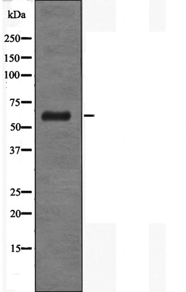 CD89 Antibody in Western Blot (WB)