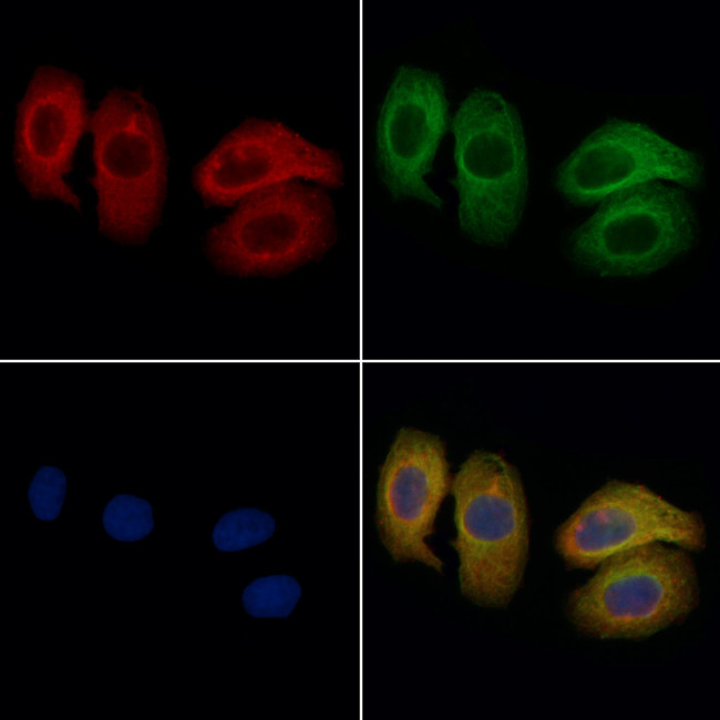 FceR1 alpha Antibody in Immunocytochemistry (ICC/IF)
