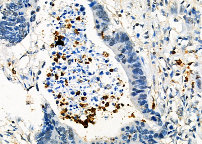 FGL2 Antibody in Immunohistochemistry (Paraffin) (IHC (P))