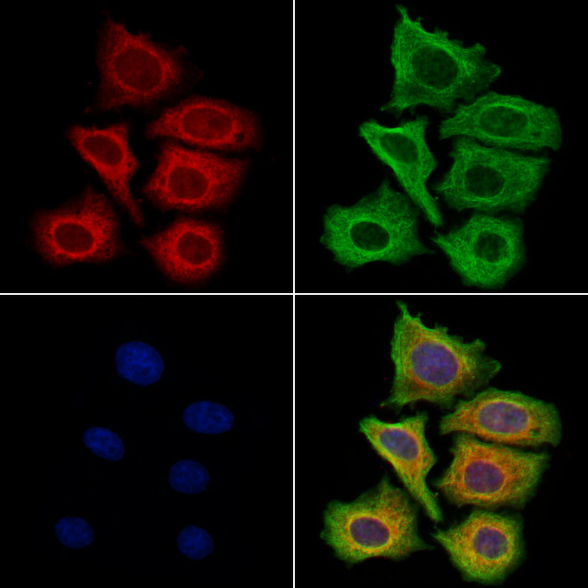 Filaggrin Antibody in Immunocytochemistry (ICC/IF)