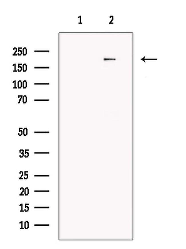 FKBP15 Antibody in Western Blot (WB)