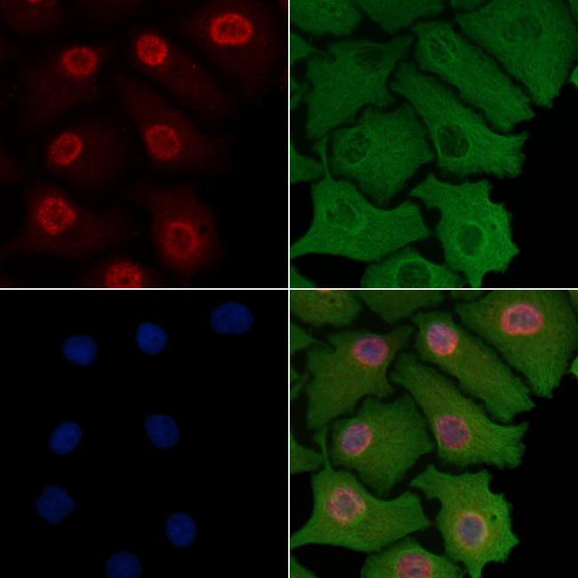 FOXK1 Antibody in Immunocytochemistry (ICC/IF)