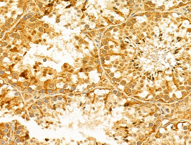 FOXR2 Antibody in Immunohistochemistry (Paraffin) (IHC (P))