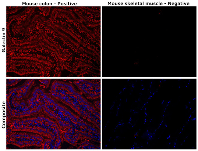 Galectin 9 Antibody in Immunohistochemistry (Paraffin) (IHC (P))