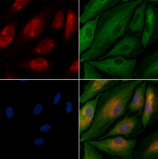 GFR alpha-3 Antibody in Immunocytochemistry (ICC/IF)