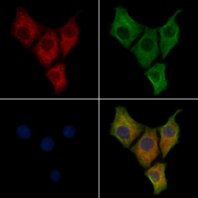 GM2A Antibody in Immunocytochemistry (ICC/IF)