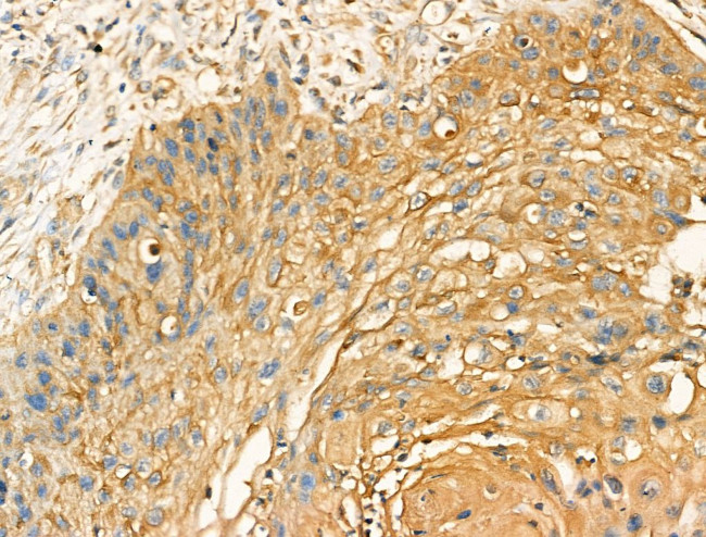GOLIM4 Antibody in Immunohistochemistry (Paraffin) (IHC (P))