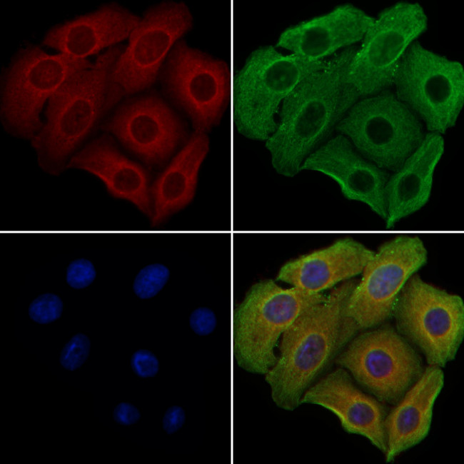 GPSM2 Antibody in Immunocytochemistry (ICC/IF)