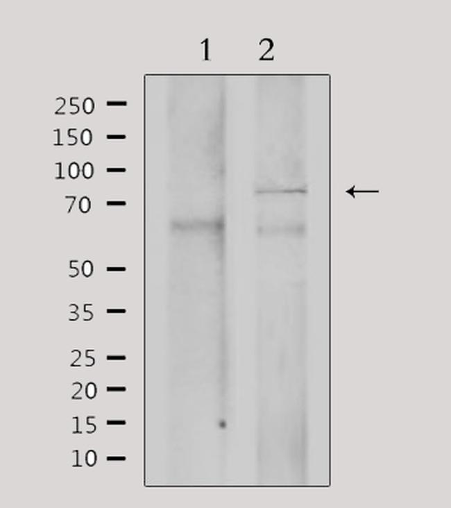 GRK3 Antibody in Western Blot (WB)