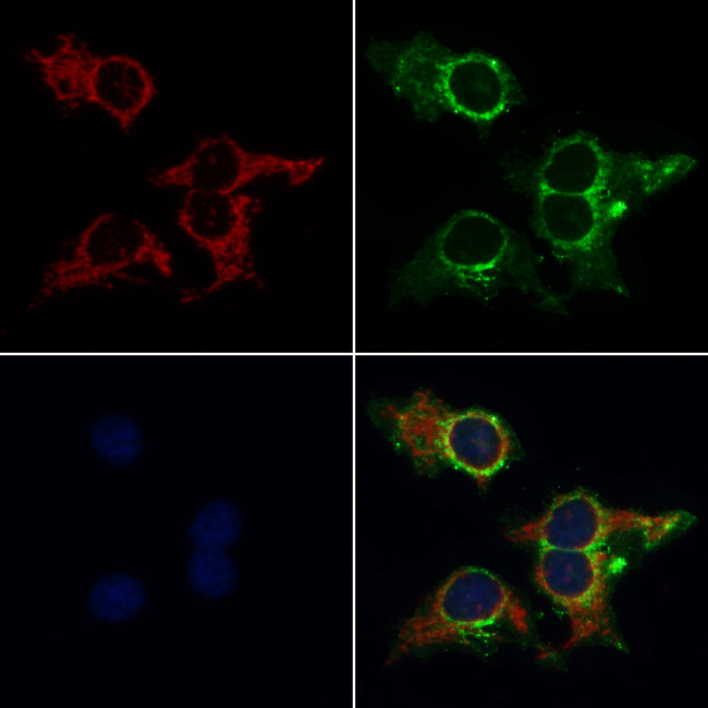 HSPA9 Antibody in Immunocytochemistry (ICC/IF)
