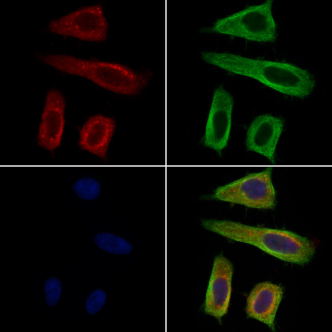 GUCY1A2 Antibody in Immunocytochemistry (ICC/IF)