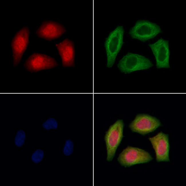 TNRC6A Antibody in Immunocytochemistry (ICC/IF)