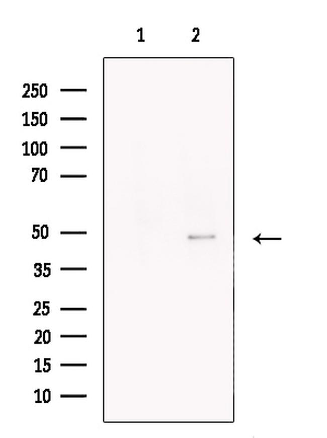 KRT40 Antibody in Western Blot (WB)
