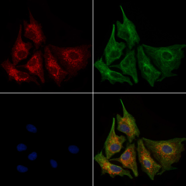 ErbB2 (HER-2) Antibody in Immunocytochemistry (ICC/IF)