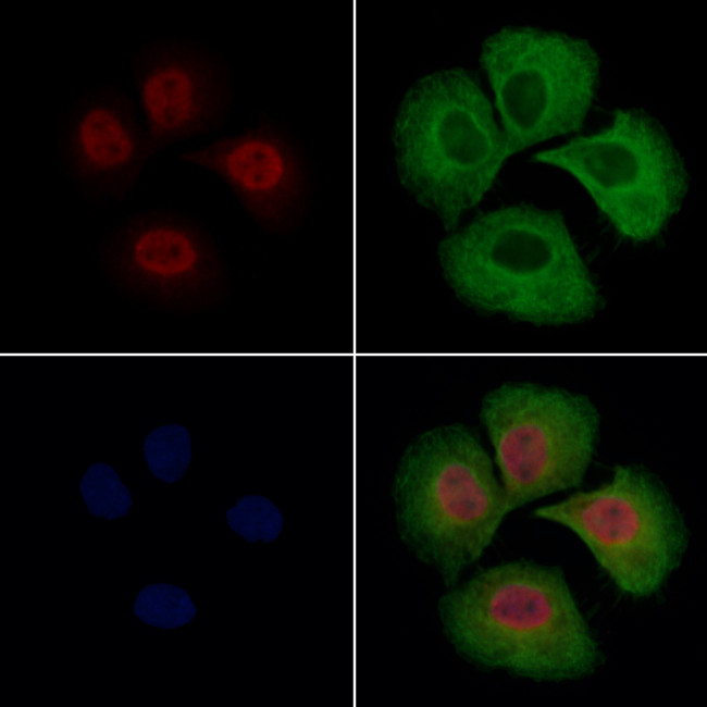 KIAA1794 Antibody in Immunocytochemistry (ICC/IF)