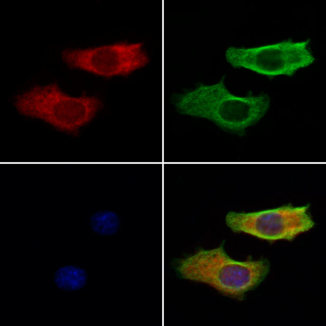 Hippocalcin Antibody in Immunocytochemistry (ICC/IF)