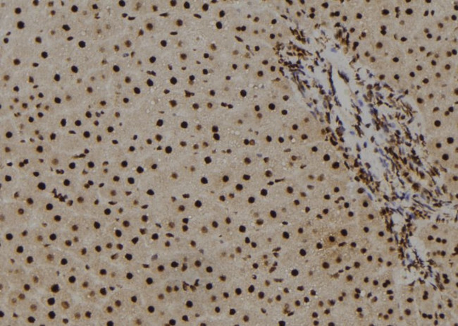 Histone H2B Antibody in Immunohistochemistry (Paraffin) (IHC (P))