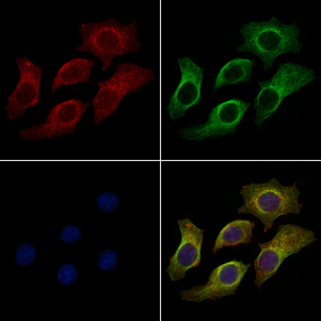 HLA-ABC Antibody in Immunocytochemistry (ICC/IF)