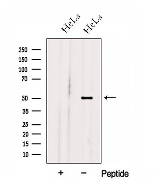 HOXA10 Antibody in Western Blot (WB)