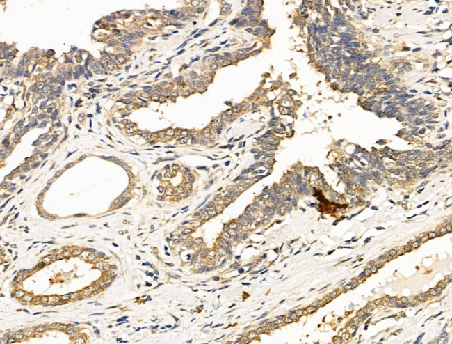HOXA4 Antibody in Immunohistochemistry (Paraffin) (IHC (P))