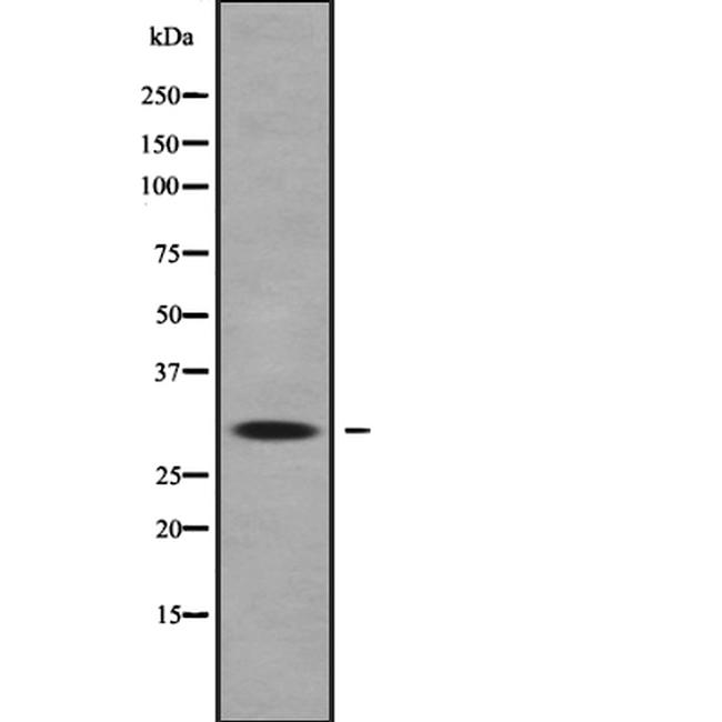 HOXC9 Antibody in Western Blot (WB)