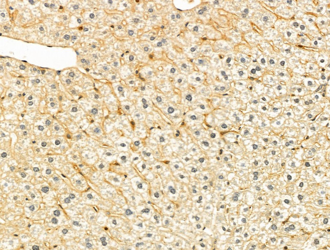 HPS3 Antibody in Immunohistochemistry (Paraffin) (IHC (P))