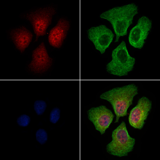 HSP20 Antibody in Immunocytochemistry (ICC/IF)