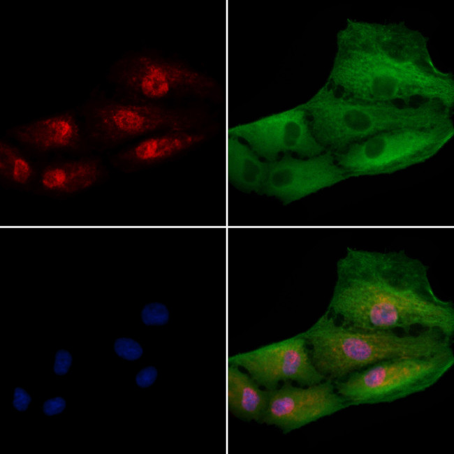 iASPP Antibody in Immunocytochemistry (ICC/IF)