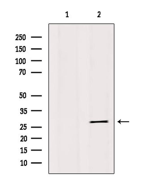 IGFBP4 Antibody in Western Blot (WB)
