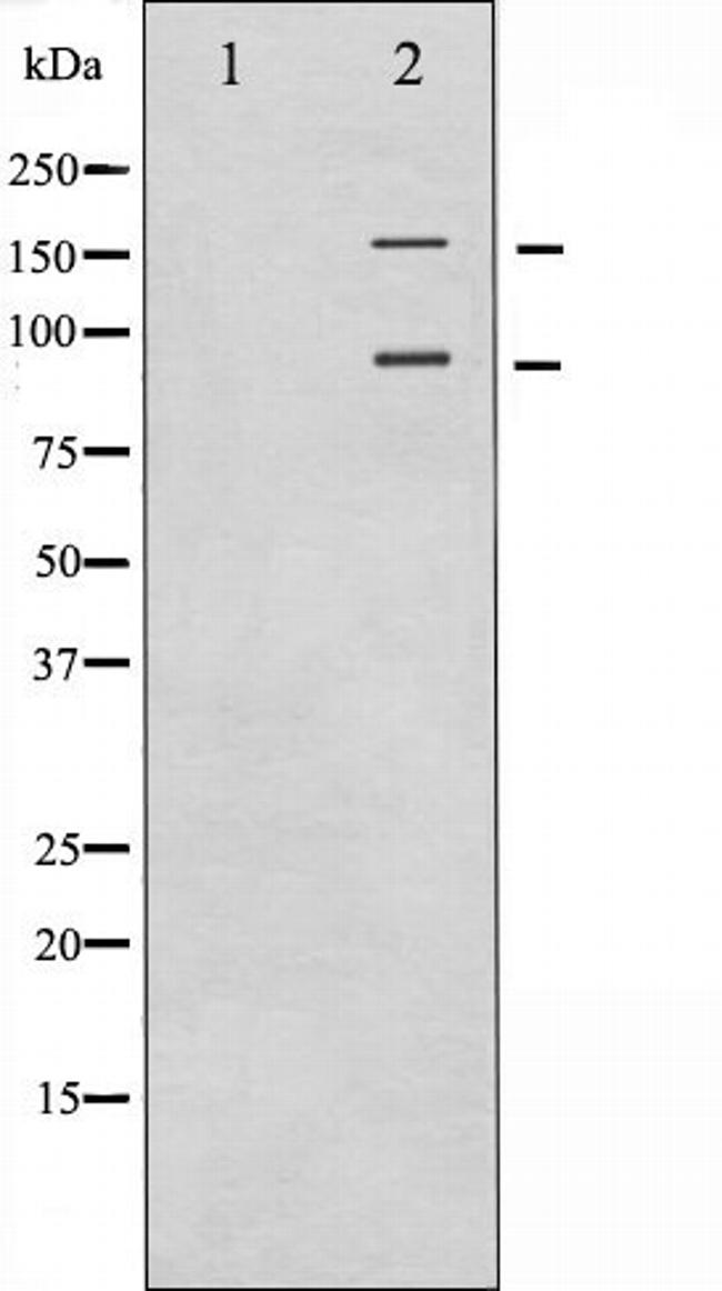 IR/IGF1R Antibody in Western Blot (WB)