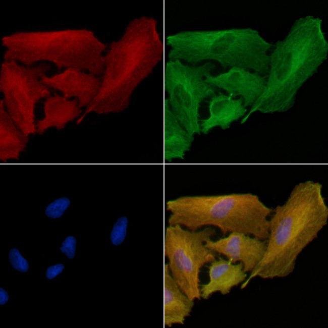 IGFBP6 Antibody in Immunocytochemistry (ICC/IF)