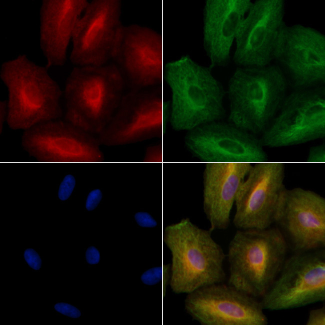 Ihh Antibody in Immunocytochemistry (ICC/IF)