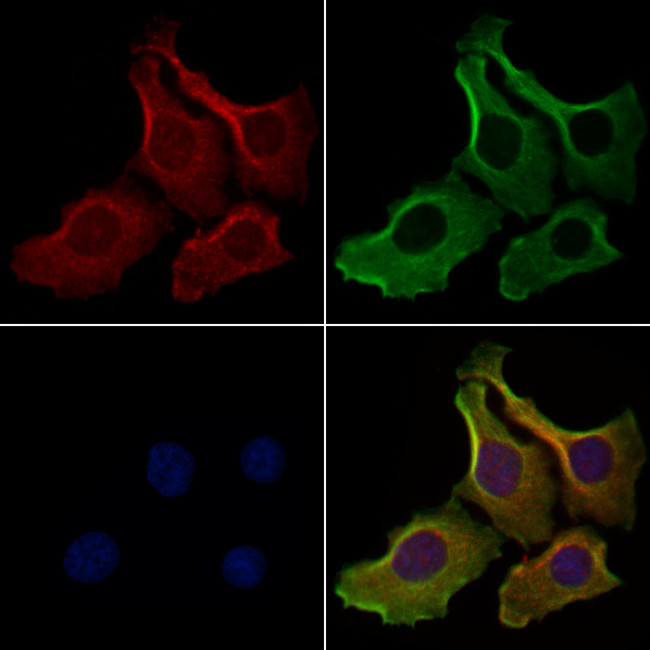 IL-17F Antibody in Immunocytochemistry (ICC/IF)