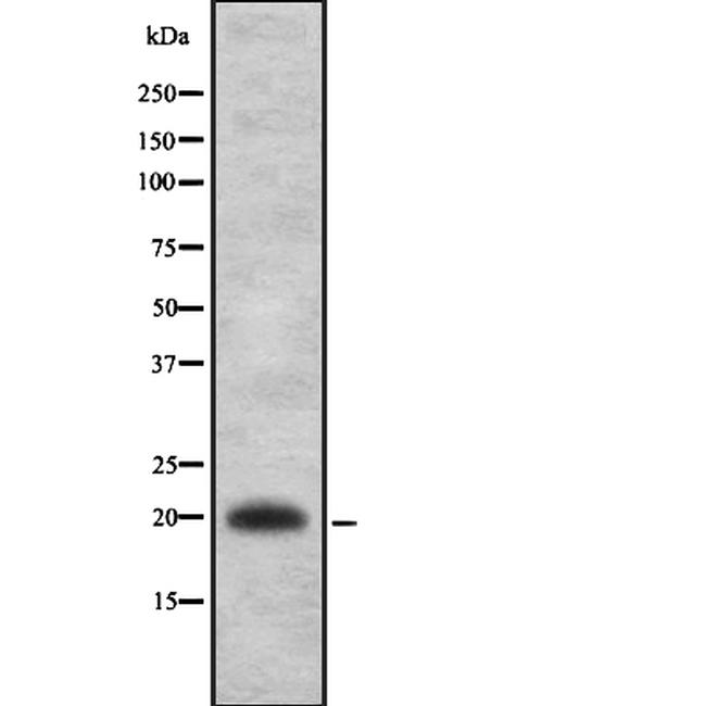 IL-22 Antibody in Western Blot (WB)