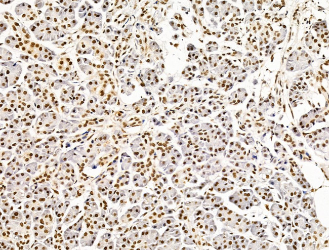 ILF1 Antibody in Immunohistochemistry (Paraffin) (IHC (P))