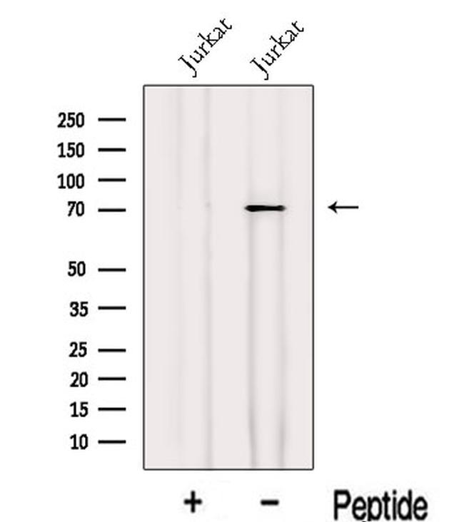 RC74 Antibody in Western Blot (WB)