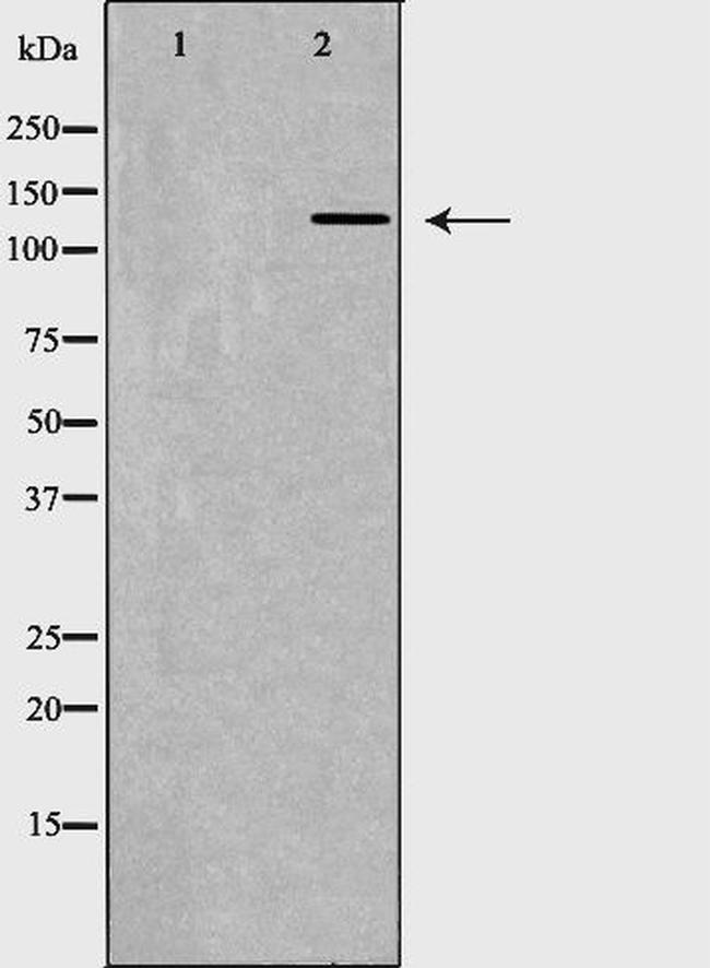 CD11a Antibody in Western Blot (WB)